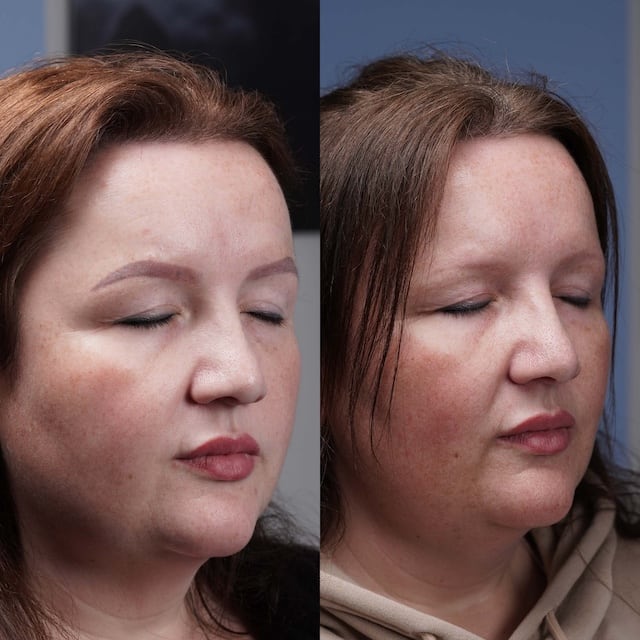 2024 5 3_Microbladed%20brows%20after%204%20treatments