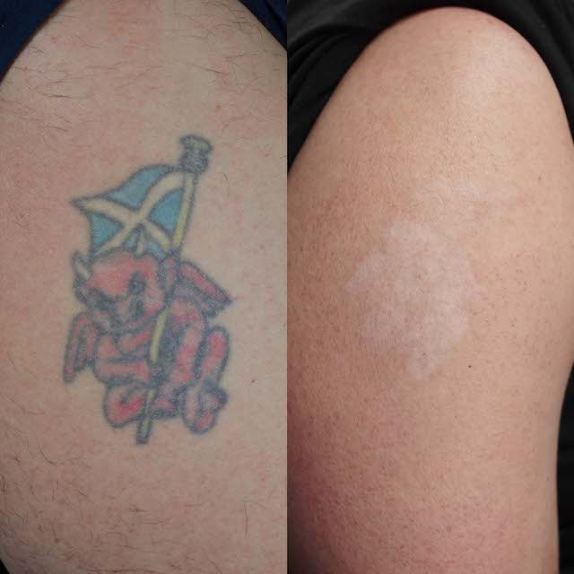 military tattoo